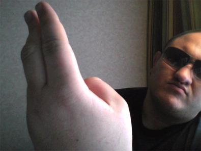 Samoa Joe Injury Photos
