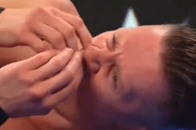 The Miz potential nose injury